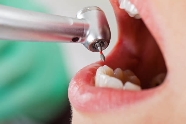 Best Dentist for Tooth Abscess  in Ridgewood, NJ